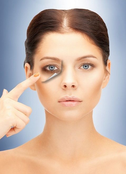 درمانهای جدید برای رفع تیرگی زیر چشم